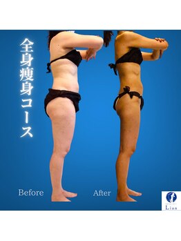 リアン(Lian)/【痩身で健康に痩せたい方】