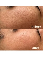 イリマレイサロン(iLima Lei SALON)/ハーブ〈before/after〉