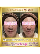 アイリープ(eyeleap)/☆脂肪分解剤【レモンボトル】