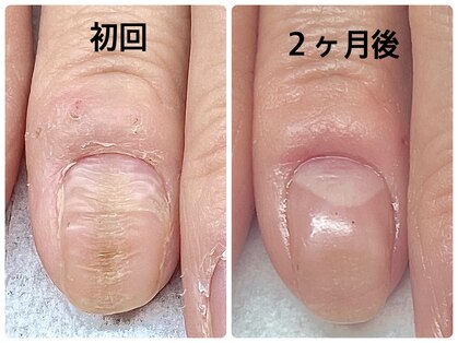 ネイルサロンエマ(EMA)の写真