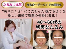 アンリエッタ(Unlieta)