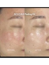 ケーブロッサムビューティーサロン(K Blossom Beauty Salon)/水光３Dピール！