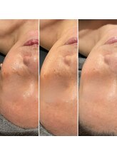 泡のきもち/【うるおいハリ艶ケア】1→3回目