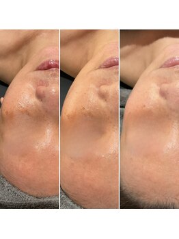 泡のきもち/【うるおいハリ艶ケア】1→3回目