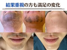 ジェムの森の雰囲気（「 美容脱毛舐めてました 」と効果実感の声多数♪）