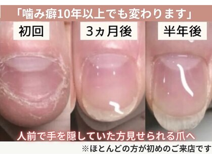 ルソア(LeSoar)の写真