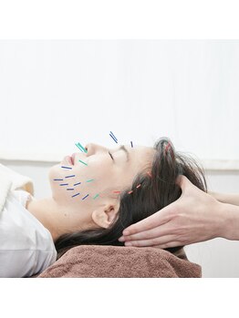 蒼月(aotsuki)の写真/シミ/しわ/ほうれい線などでお悩みの方にお勧め◎美容鍼で肌の修復機能を高めて肌悩みを改善・ケア♪