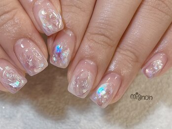 ミニョン(mignon)/mignon定額コース