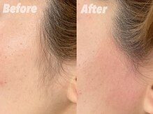 スウィートラッシュ 川口店(Sweet Lash)/フェイスwax