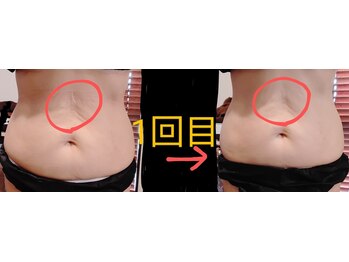 フロレゾン(Floraison)/どんな脂肪もおまかせ!