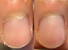メンズ ネイル トノ(Men's Nail TONO)の雰囲気（衝撃のビフォーアフター！/メンズネイル）