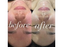 マヤヒメ(mayahime)/美肌は当店にお任せ