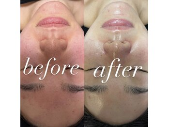 マヤヒメ(mayahime)/美肌は当店にお任せ