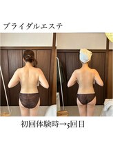 イム(I'm.)/ブライダル before/after