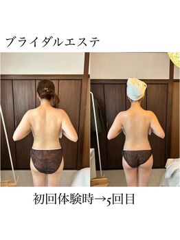 イム(I'm.)/ブライダル before/after