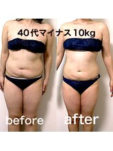 エステサロンクオーツ/全身痩身コース