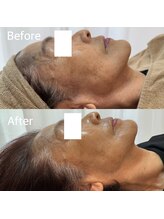 エー(A)/ビフォーアフター