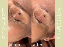 健志接骨院/πテラピー造顔メソッド