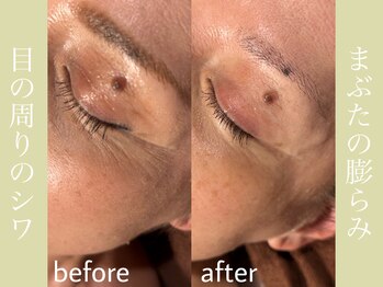 健志接骨院/πテラピー造顔メソッド