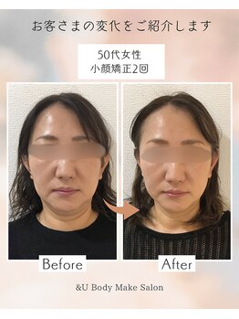 アンドユー(&U)/