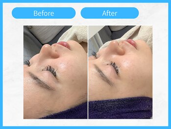 トウメイコガオ 横浜店/