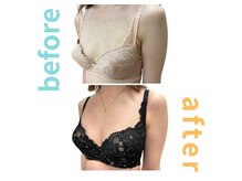 シエル(Ciel)/バストアップ施術３回目→７回目