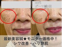 皇漢堂鍼灸療院の雰囲気（シワが気になる方は★最新美容鍼【ダーマ鍼】モニター特別価格）