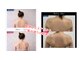 シアン(CYAN)の写真/整体×エステで内側から整え外側から磨く。理想の姿勢と美しいボディラインを叶えるブライダルケア