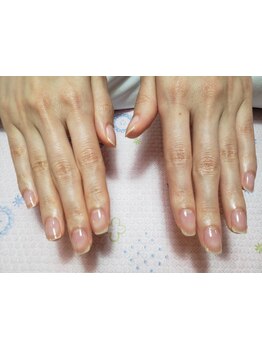 爪の悩みを解消できる（ケア含む）