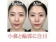 ラプリボーテ(Raplit BEAUTE)の写真