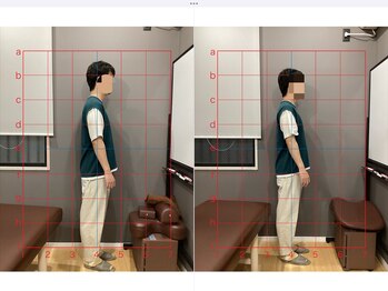 摂津本山駅前鍼灸整骨院/ビフォーアフターになります！