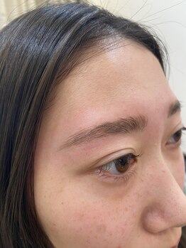 プルメリア(Plumeria)/