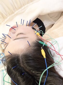 瑞 鍼灸院/美容施術