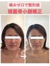 技術力の高さが人気◎《解剖学に基づく本格技術♪☆》頭蓋骨小顔矯正