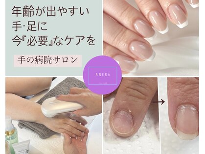 アネラ(ANERA)の写真