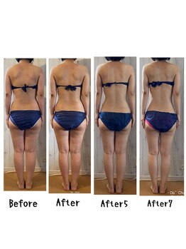 ダチュラ(Da'Chura)/メディセル☆筋膜リリース(痩身)