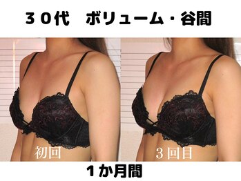 バストサロン メルベイユ(Merveile)/丸み/ボリュームUP/谷間クッキリ