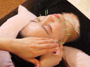 藤本整骨院 鍼灸院 長崎岩屋町本院/美容鍼メニューも♪