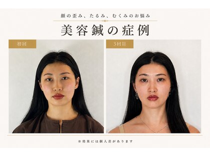 鍼灸院グロリアス 銀座(Glorious)の写真