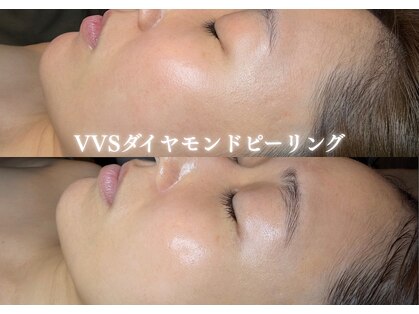 ルーンフェイシャルサロン 吉祥寺(Lune facial salon)の写真