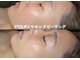 ルーンフェイシャルサロン 吉祥寺(Lune facial salon)の写真