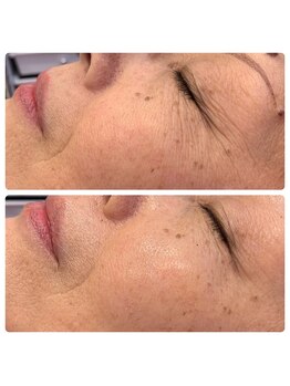 アイラッシュ ミル 御領店(eye lash Miru)/エイジングケア