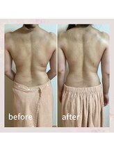 セレーネ(Selene)/お疲れ改善！リンパケア！