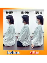 ストレッチヒーロー 福山神辺店/ビフォーアフター【1回の変化】