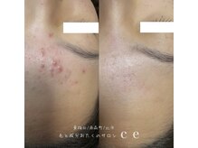 シャルム エスボーテ(charme Esbeaute)の雰囲気（肌質改善お任せ下さい♪ 細胞学に基づいたサイエンスケア）