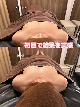 華月(KAGETSU)/初回でこれだけの結果が出ました