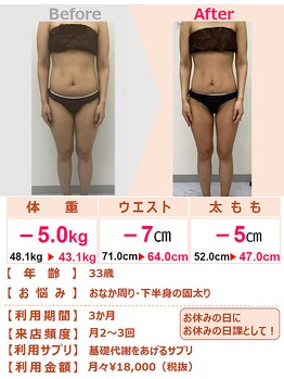 スリムステーション 川西市(Slim Station)/太ももの悩みも3か月ですっきり