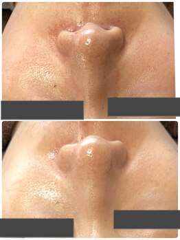 ビーカーブス 三鷹(B.curves)/before・after