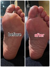 メディカルジャパン 吉祥寺/フットケア