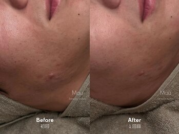 マウ(Mau)/お肌に優しいソフトハーブ